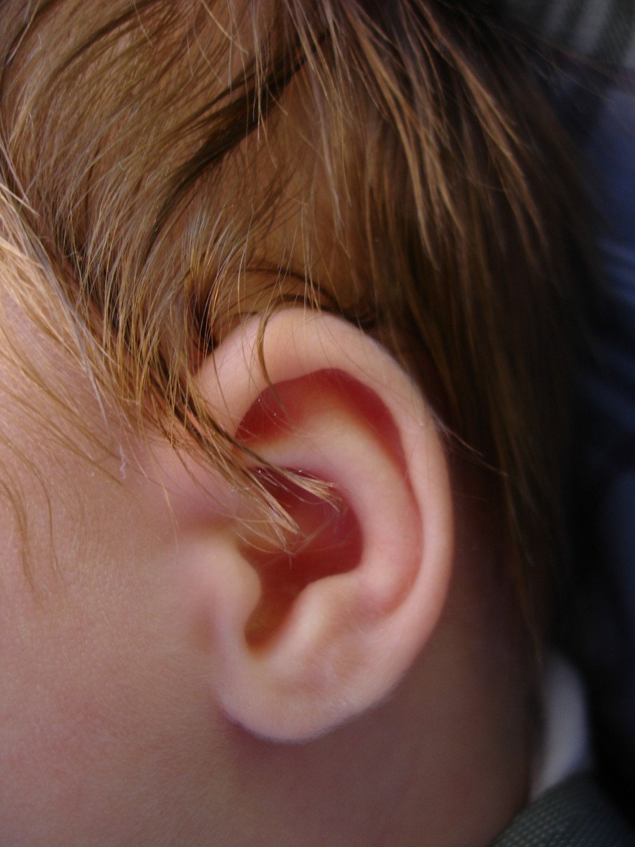 breakthrough-florida-study-predicts-speech-therapy-needs-for-children-with-hearing-loss-focus