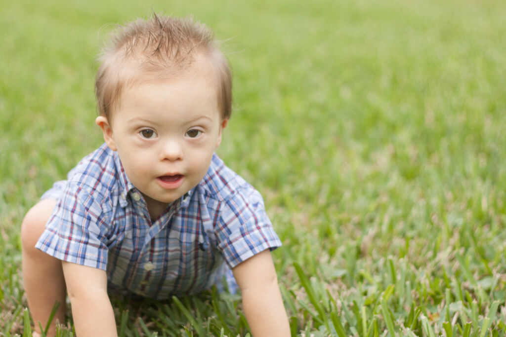 Children With Down Syndrome Do Better With Speech Therapy Focus Therapy