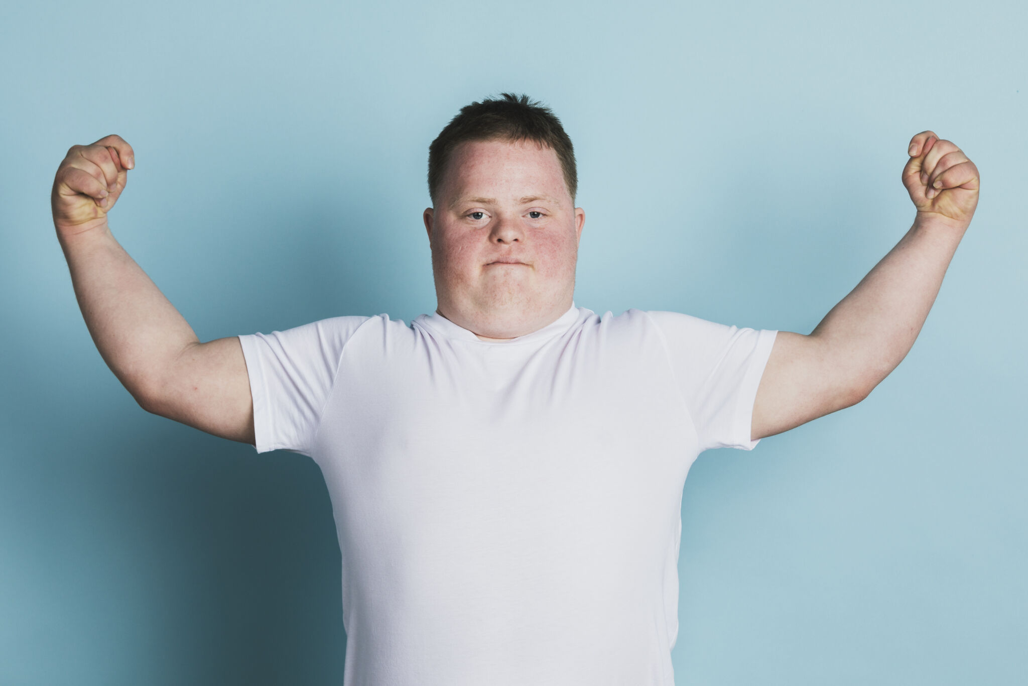 FOCUS Physical Therapists Can Help Kids With Down Syndrome Stay Fit